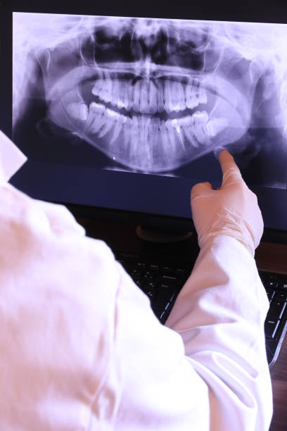 Best Broken or Chipped Tooth Repair in Broussard, LA