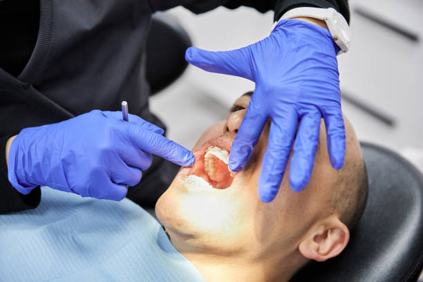 Best Lost Filling or Crown Replacement in Broussard, LA